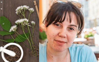 Naturopathy for Adult acne