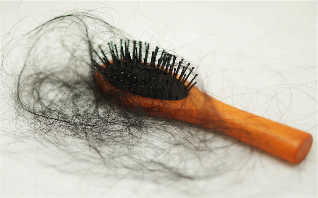 Female hair loss: Why it happens and what you can do about it