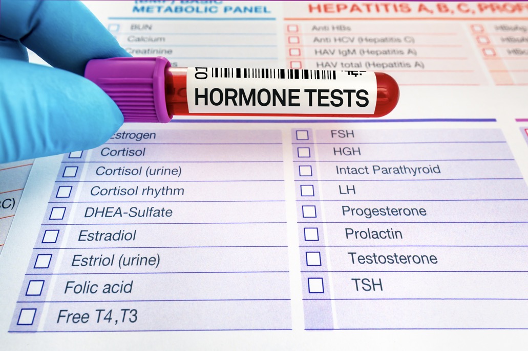 A gloved hand holding a vial of blood and a pathology request form for hormone testing