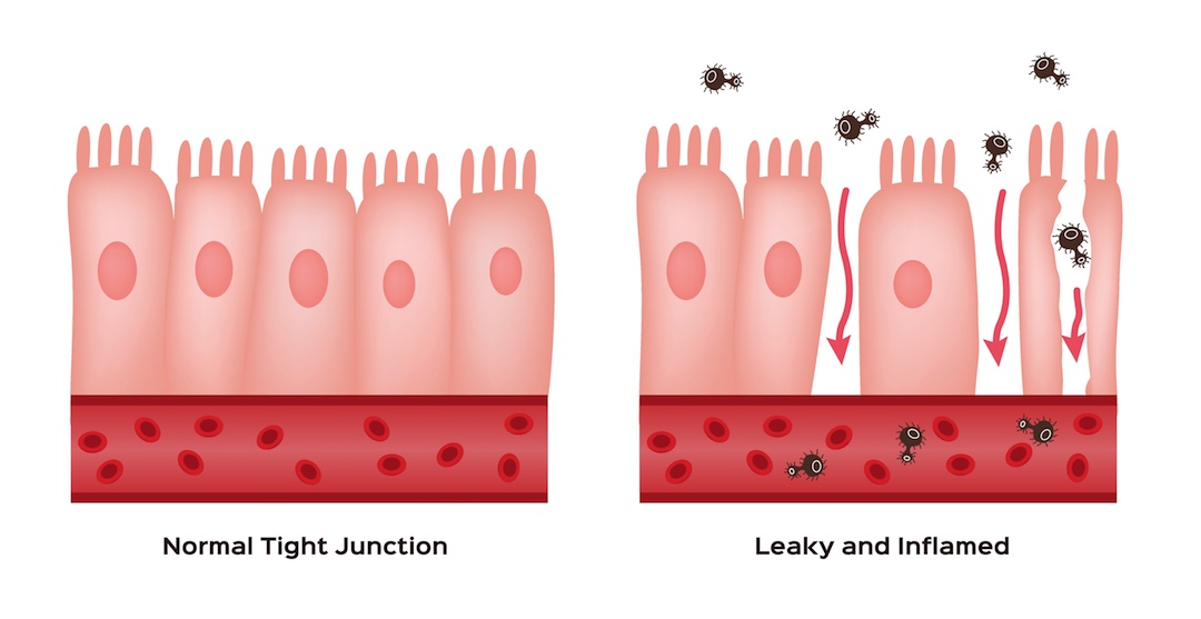 diagram of intestinal permeability